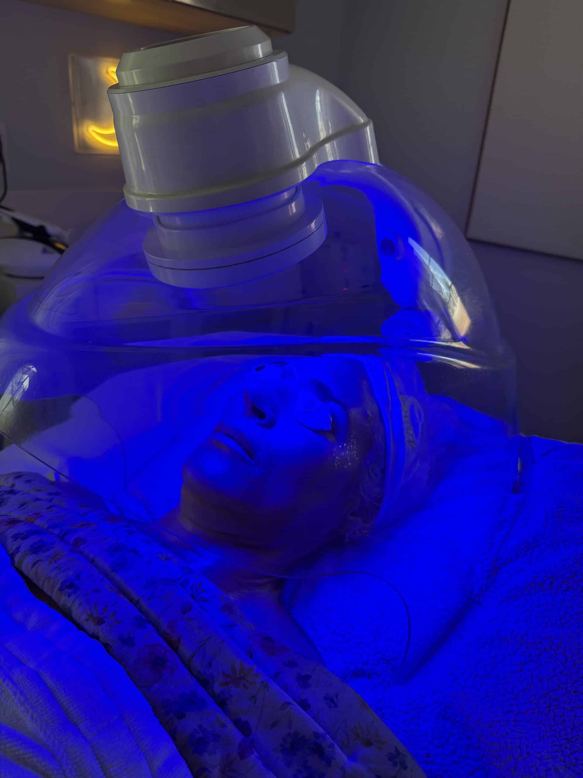 acne facial